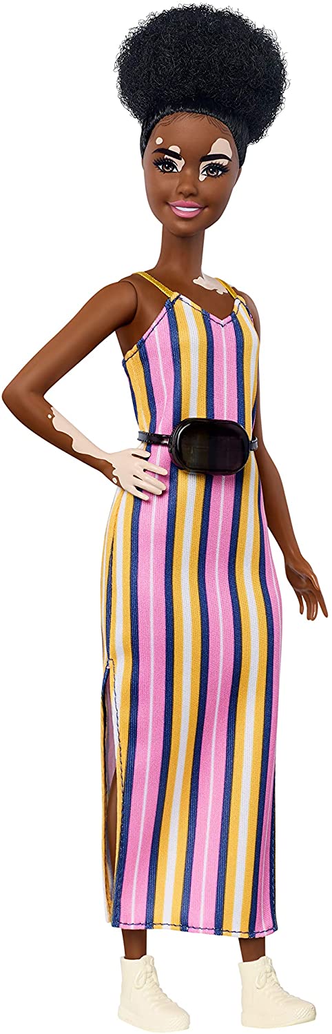Barbie Fashionistas Doll with Vitiligo and Curly Brunette Hair Wearing Striped Dress and Accessories, for 3 to 8 Year Olds