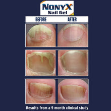 Load image into Gallery viewer, NONYX Fungal Nail Clarifying Gel, Clears Out Keratin Debris Where Nail Fungus Thrives, 4 oz.