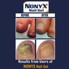 Load image into Gallery viewer, NONYX Fungal Nail Clarifying Gel, Clears Out Keratin Debris Where Nail Fungus Thrives, 4 oz.